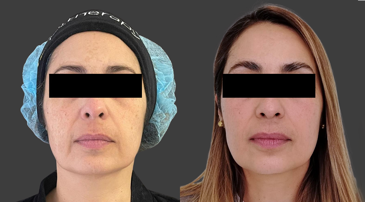 Piel & cuerpo — foto 3